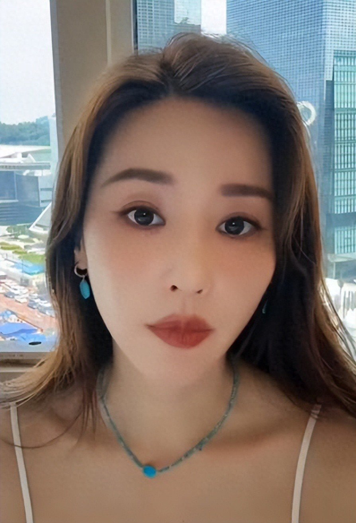 吴佳尼曝有演员打完肉毒没法拍戏，图片 1